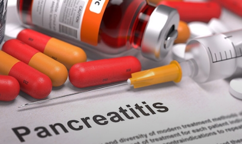 Pankreatitis: wenn sich die Bauchspeicheldrüse entzündet